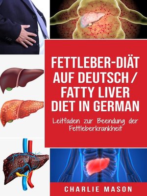 cover image of Fettleber-Diät Auf Deutsch/ Fatty liver diet In German